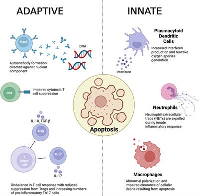 The Role of Immunometabolism in the Pathogenesis of Systemic Lupus Erythematosus